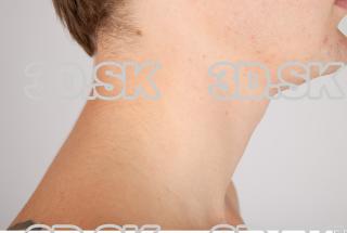 Neck texture of Aurel 0004